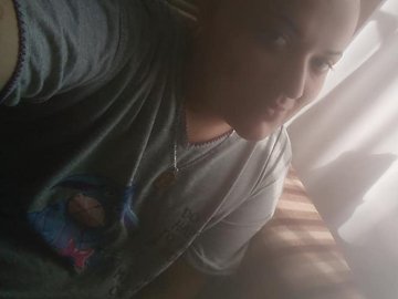 20-річній волинянці потрібні кошти на боротьбу з раком