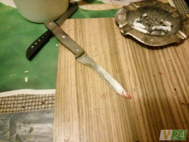  Приревнував: п’яний лучанин до крові побив дружину. ФОТО