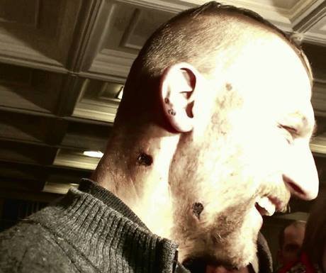 Козак, з якого знущалися беркутівці: Чекаю, коли вип`ємо за перемогу