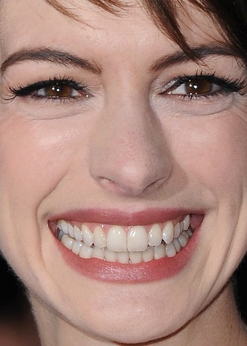 Зіркові люди зблизька. Фу-фу-фу....